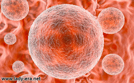 Case Of Chlamydia