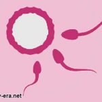 Causes Of Infertility